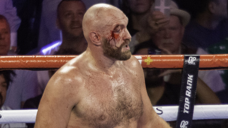 Тайсон Фьюри