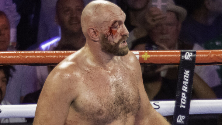 Тайсон Фьюри