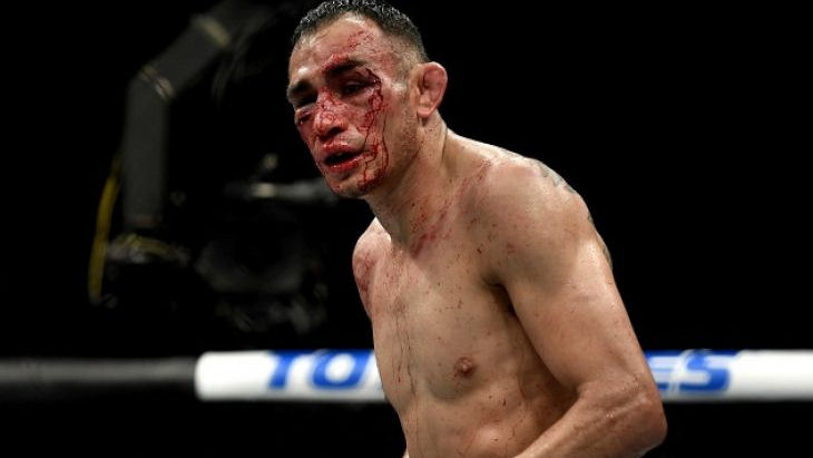 Тони Фергюсон